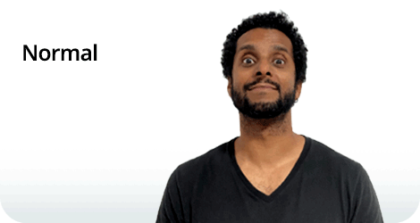 Composição com texto e fotografia. À esquerda, está escrita a palavra “Normal” em letras pretas. À direita, um homem de pele parda, cabelos cacheados, curtos e pretos, e barba preta, com o corpo voltado para frente e a cabeça levemente inclinada para cima. Ele olha para a frente com os olhos bem abertos e sobrancelhas erguidas e esboça um leve sorriso, com a boca fechada.

