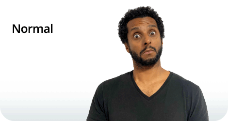 Composição com texto e fotografia. À esquerda, está escrita a palavra “Normal” em letras pretas. À direita, um homem de pele parda, cabelos cacheados, curtos e pretos, e barba preta, com o corpo voltado para frente e a cabeça levemente inclinada para a direita. Ele olha para a frente com os olhos bem arregalados e sobrancelhas erguidas.