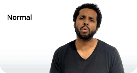 Composição com texto e fotografia. À esquerda, está escrita a palavra “Normal” em letras pretas. À direita, um homem de pele parda, cabelos cacheados, curtos e pretos, e barba preta, com o corpo voltado para frente e a cabeça levemente inclinada para direita. Ele franze a testa, olha para a frente com os olhos semicerrados e está com os lábios projetados para a frente, como se estivesse assobiando.