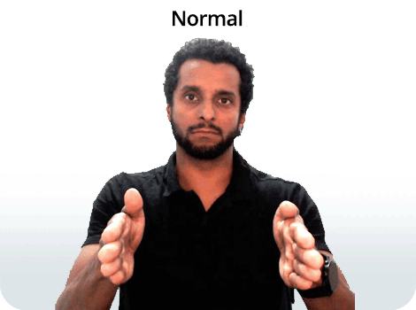 Composição com texto e fotografia. Na parte superior, está escrita a palavra “Normal” em letras pretas. Abaixo, um homem de pele parda, cabelos cacheados, curtos e pretos, e barba preta, com o corpo voltado para frente. Ele aparece da barriga para cima, com expressão neutra, olhando para a frente e com os braços à frente do corpo. As palmas das mãos estão voltadas uma para a outra, com os dedos estendidos e apontados para a frente.